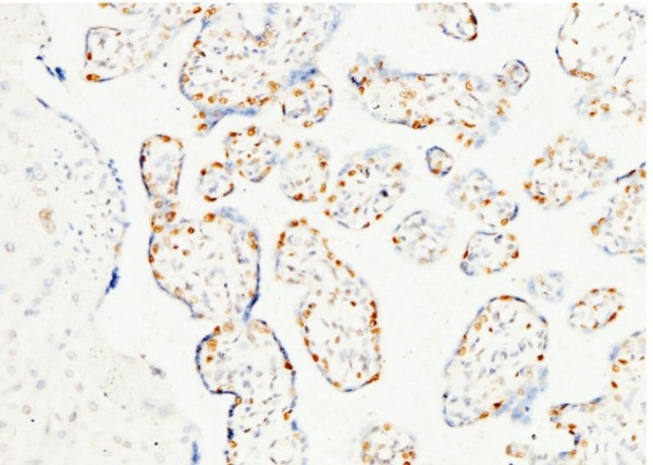 PARP-1/PARP Monoclonal Antibody (AN200038P)