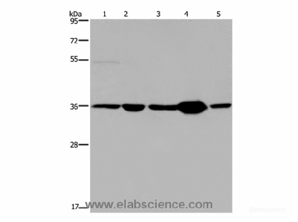 LZTFL1 Polyclonal Antibody (E-AB-11375)