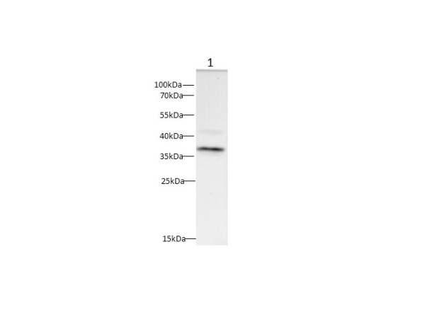 CD20 Polyclonal Antibody (D-AB-10179L)