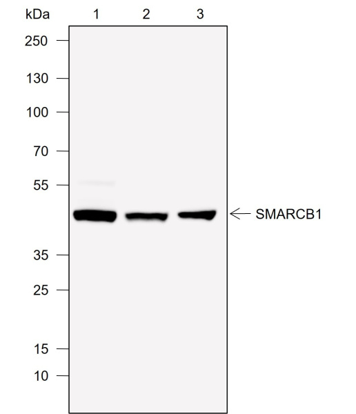 Recombinant SMARCB1/BAF47 Monoclonal Antibody (AN302046L)