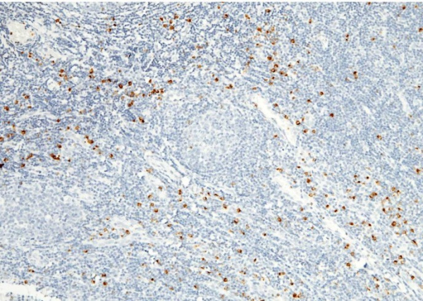 Recombinant Granzyme B/GZMB Monoclonal Antibody (AN300323P)