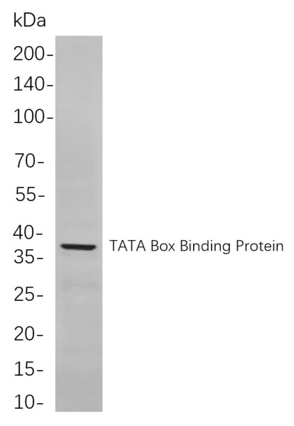 Recombinant TATA Box Binding Protein Monoclonal Antibody (AN301051L)