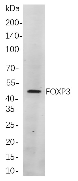 Recombinant FOXP3 Monoclonal Antibody (AN301023L)
