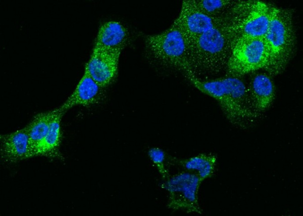 Recombinant IFITM1 Monoclonal Antibody (AN300170P)