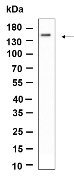 Recombinant SMC3 Monoclonal Antibody (AN301183L)