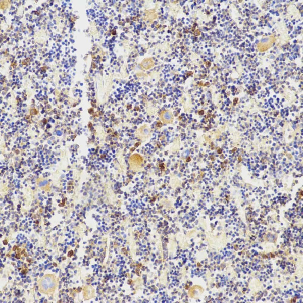 TNFRSF11B Polyclonal Antibody (E-AB-70067)