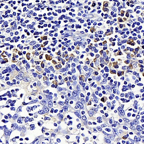 SIRT7 Polyclonal Antibody (E-AB-70223)
