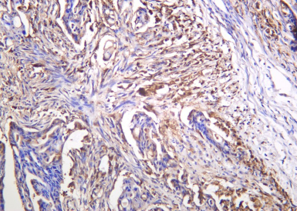 Recombinant Galectin-3 Monoclonal Antibody (AN301191L)