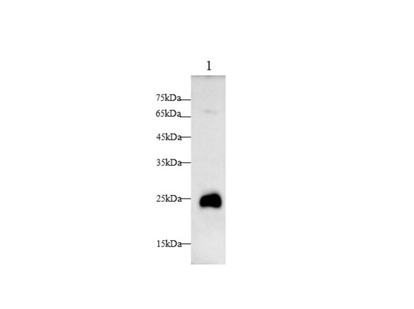 TREM1 Polyclonal Antibody (AN007220L)