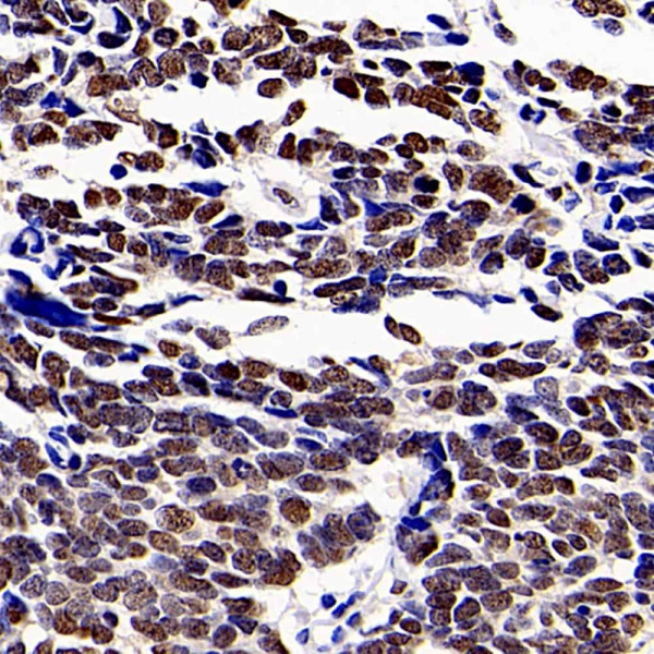 HDAC1 Polyclonal Antibody (E-AB-70201)