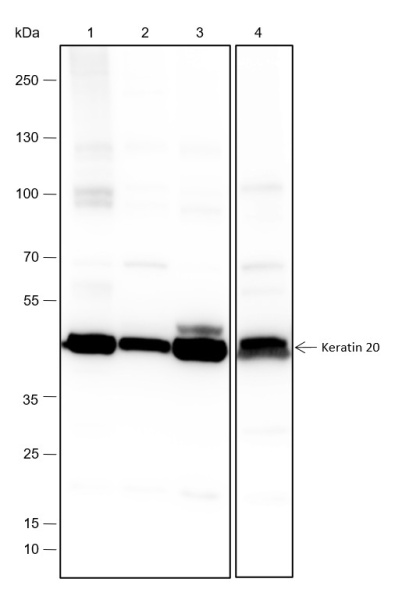 Recombinant Keratin 20 Monoclonal Antibody (AN301577L)