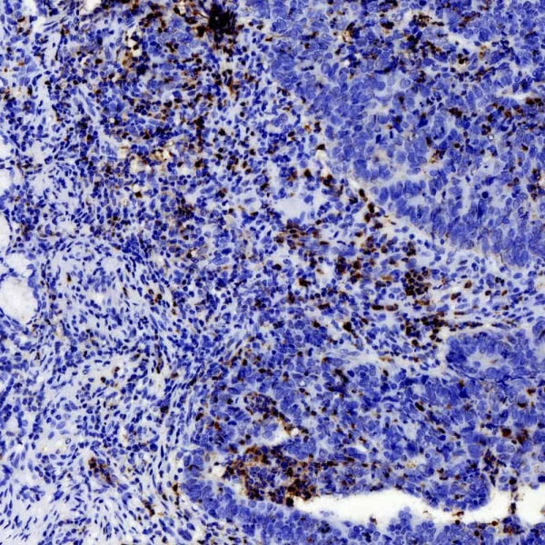 MMP9 Polyclonal Antibody (E-AB-70060)