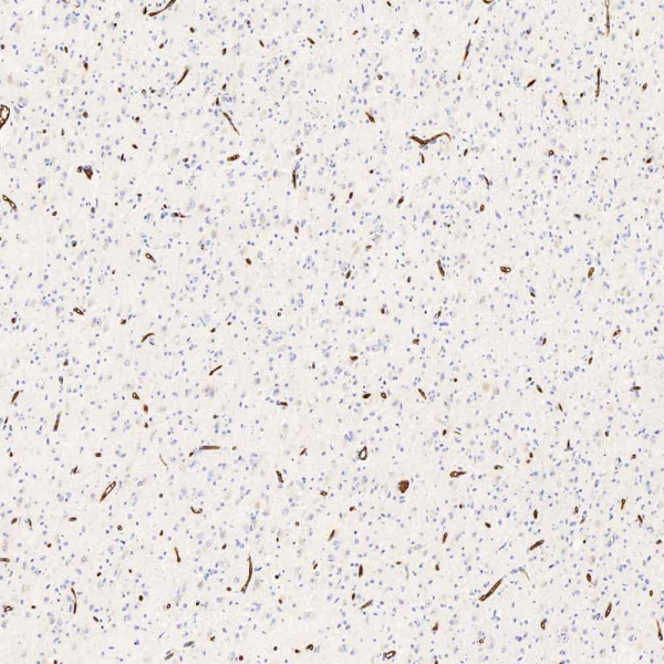GLUT-1 Polyclonal Antibody (E-AB-70090)
