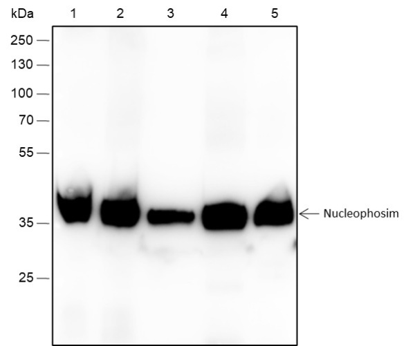 Recombinant NPM1 Monoclonal Antibody (AN301612L)