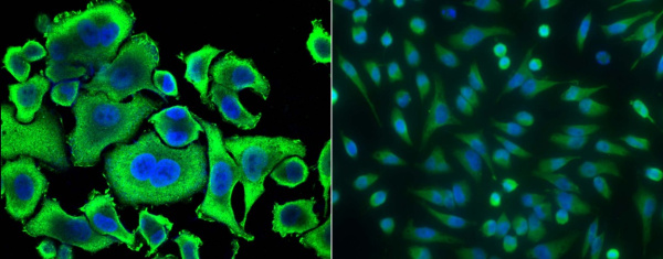 Recombinant ACY1/Aminoacylase-1 Monoclonal Antibody (AN300342P)