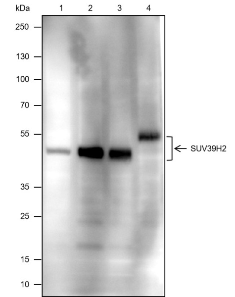 Recombinant SUV39H2 Monoclonal Antibody (AN301817L)