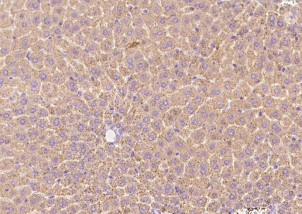 Recombinant Transferrin Receptor/TFRC Monoclonal Antibody (AN300555P)