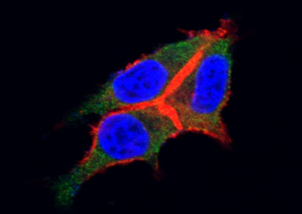 G-CSFR/CD114/CSF3R Monoclonal Antibody (AN200171P)