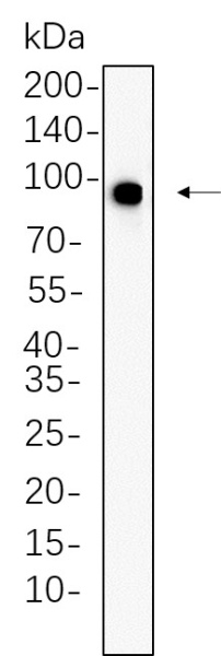 Recombinant Phospho-IGF1R (Tyr1135/1136)/Phospho-Insulin Receptor β (Tyr1150/1151) Monoclonal Antibody (AN301299L)