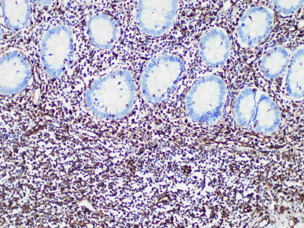 Vimentin Monoclonal Antibody (ELAB6529-R)