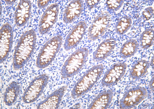 Recombinant BMP-4 Monoclonal Antibody (AN301282L)
