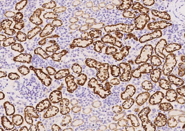 VISTA/GI24/B7-H5 Monoclonal Antibody (AN200229P)