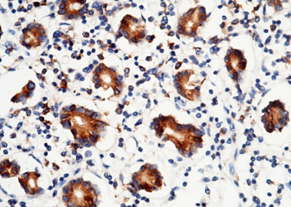 P4HB/ERBA2L Monoclonal Antibody (AN200187P)