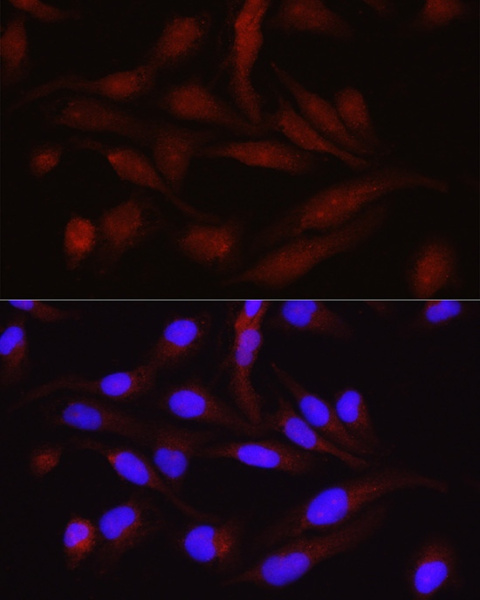 PGC1 alpha Polyclonal Antibody (E-AB-65852)