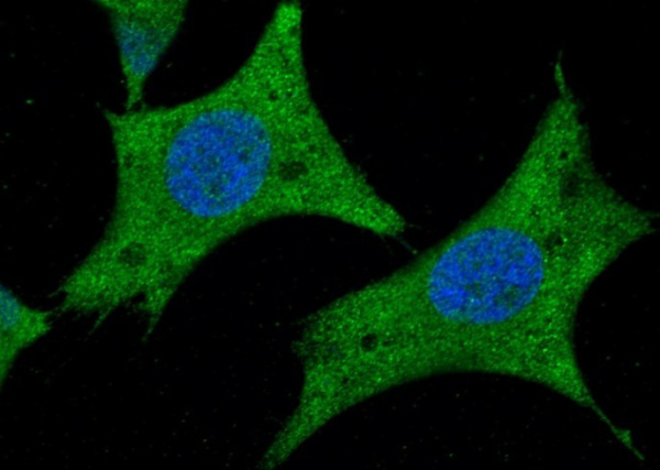 Recombinant AARSD1 Monoclonal Antibody (AN300162P)