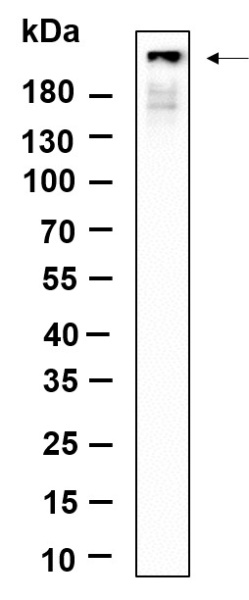 Recombinant Phospho-IRF3 (Ser396) Monoclonal Antibody (AN301389L)