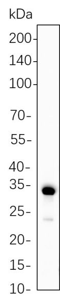 Recombinant Calponin-1 Monoclonal Antibody (AN301341L)