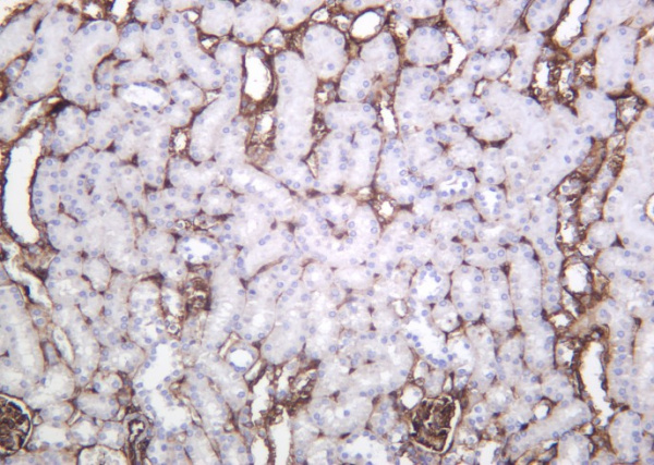 Recombinant Annexin II Monoclonal Antibody (AN301270L)