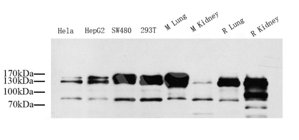 CD31 Polyclonal Antibody (E-AB-70020)