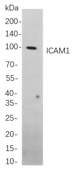 Recombinant ICAM1 Monoclonal Antibody (AN301099L)