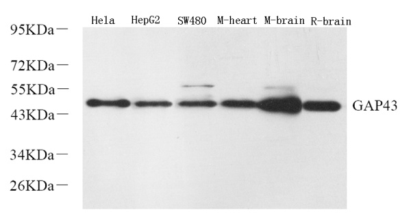 GAP43 Polyclonal Antibody (E-AB-70039)