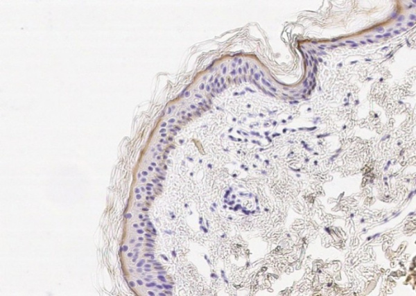 Cystatin E/CST6 Monoclonal Antibody (AN200026P)