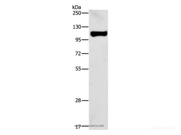 STAT6 Polyclonal Antibody (E-AB-10059)