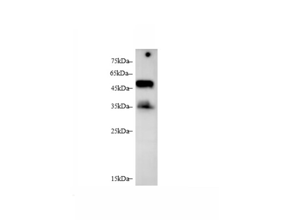 BAFFR/TNFRSF13C Polyclonal Antibody (D-AB-10443L)