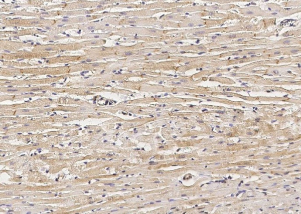 Recombinant DSC2 Monoclonal Antibody (AN300589P)