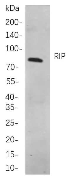 Recombinant RIP Monoclonal Antibody (AN301086L)