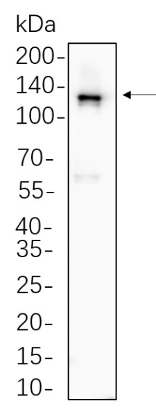 Recombinant Vinculin Monoclonal Antibody (AN300693L)