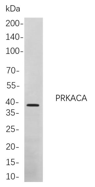 Recombinant PRKACA Monoclonal Antibody (AN300927L)