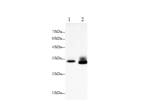 Betacellulin/BTC Polyclonal Antibody (AN005970L)