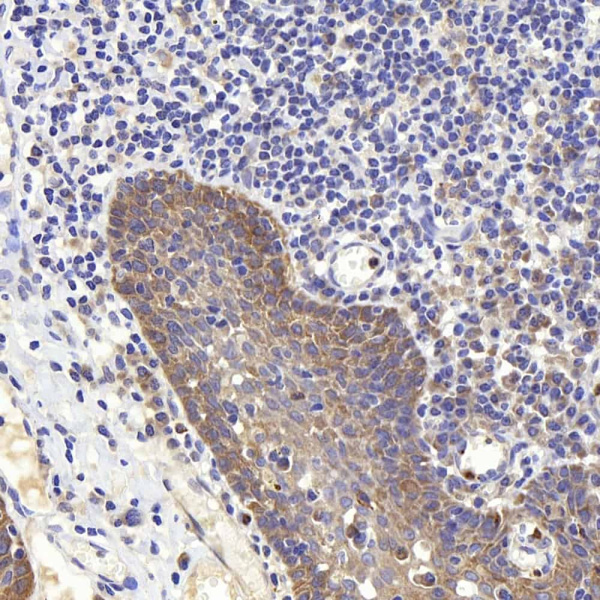 PERK Polyclonal Antibody (E-AB-70363)