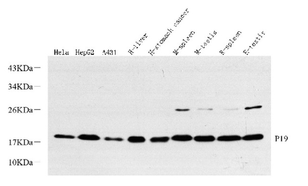 p19 INK4d Polyclonal Antibody (E-AB-70351)