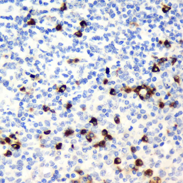 CD19 Polyclonal Antibody (E-AB-70018)