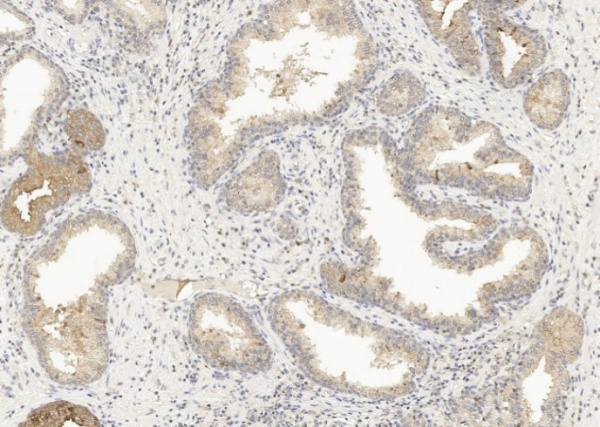 GDF15 Monoclonal Antibody (AN200035P)