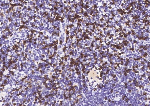 Recombinant CD8a/Lyt2 Monoclonal Antibody (AN300002P)