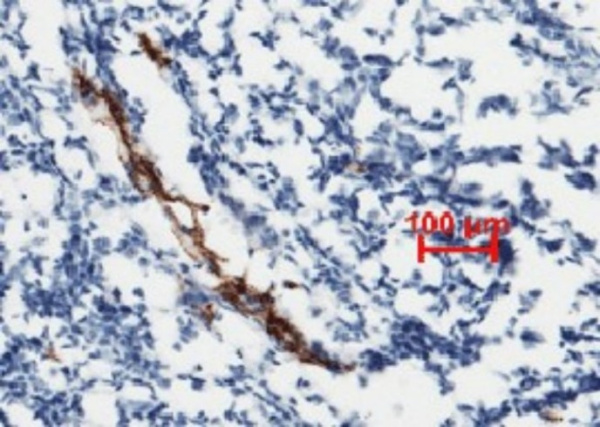 Recombinant vWF Monoclonal Antibody (AN300105P)