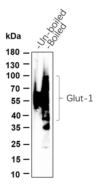 Recombinant Glut1 Monoclonal Antibody (AN301125L)